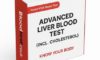 Blood Alcohol Level Testing: Essential Guide to Know
