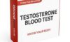 Testosterone Blood Test Guide for Sheffield Residents