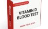 Vitamin D Blood Test Information for Residents of Lincoln